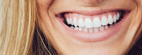 Mućkanje ulja i sve ostalo: alternativna nega zuba